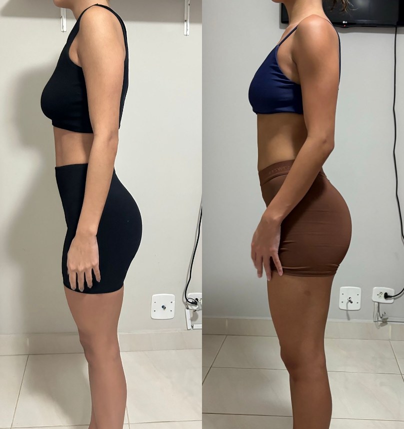 Antes e depois — aluno Torres Squad 5