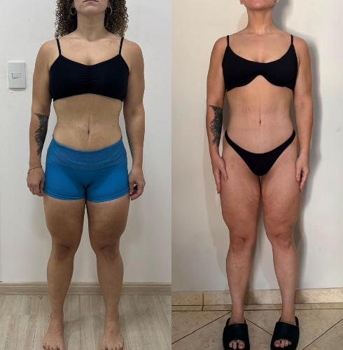 Antes e depois — aluno Torres Squad 9